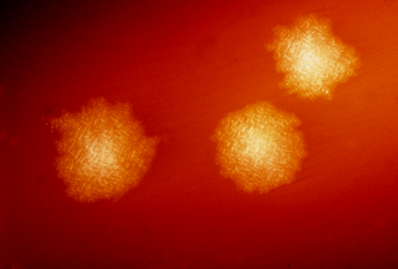 Colonia de Clostridium difficile en una placa de petri.